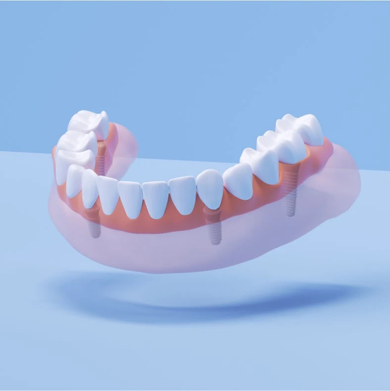 slide-1